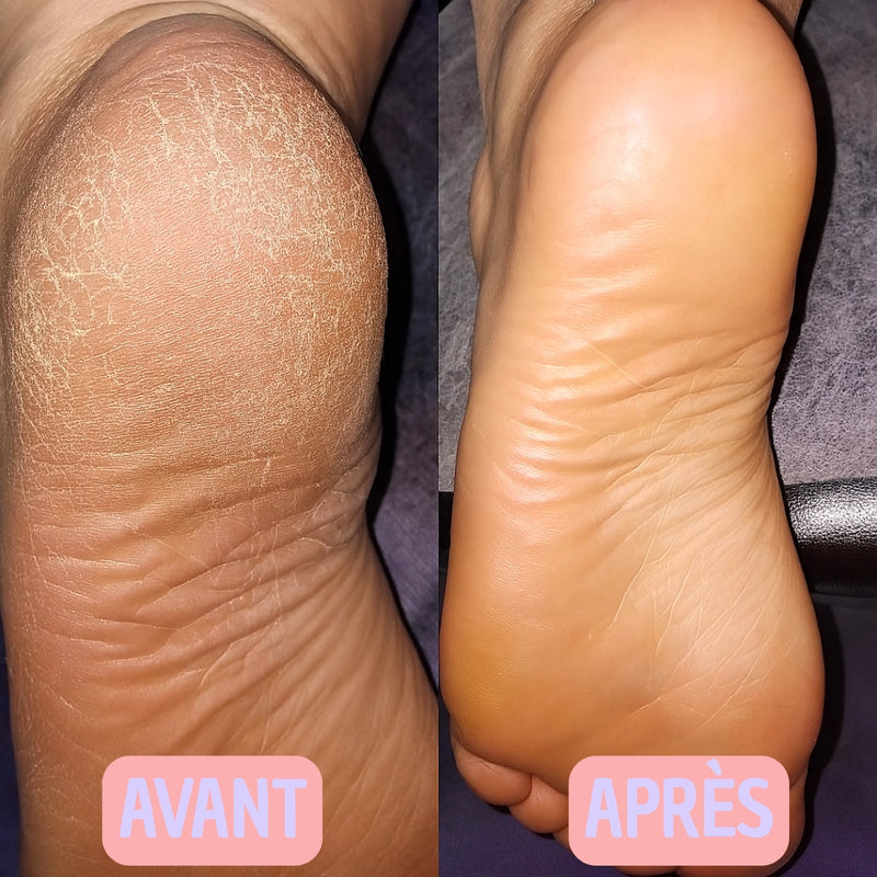 Photo avant-après
