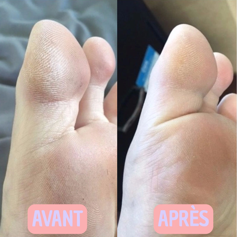 Photo avant-après
