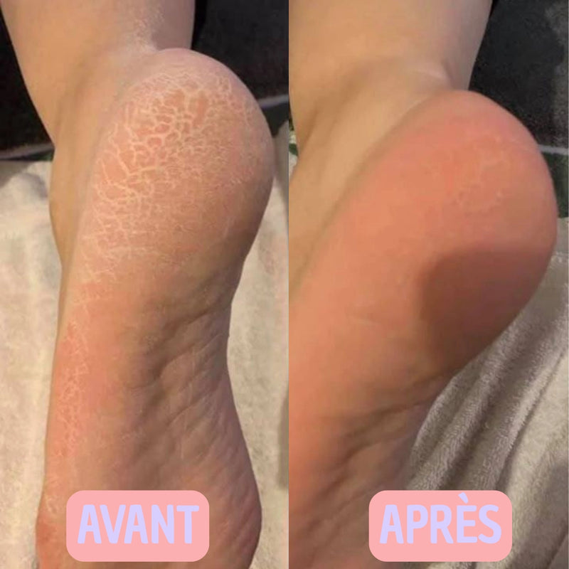 Photo avant-après