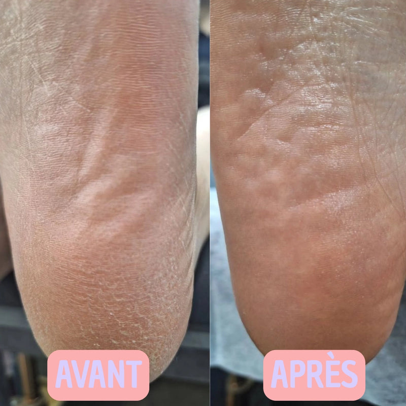 Photo avant-après