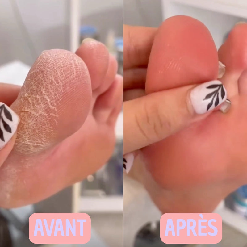 Photo avant-après